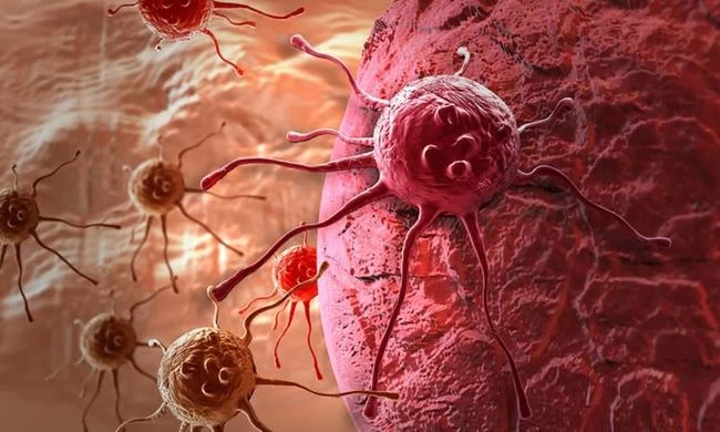 Καρκίνος: Μια νέα επαναστατική θεραπεία θα είναι έτοιμη σε λιγότερο από ένα χρόνο